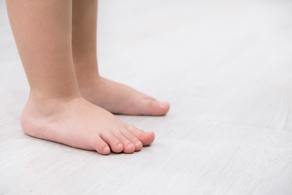 Pie plano en niños